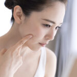 にきびとステロイド